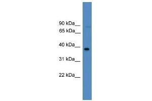 WB Suggested Anti-FOSL2 Antibody Titration:  0. (FOSL2 抗体  (Middle Region))