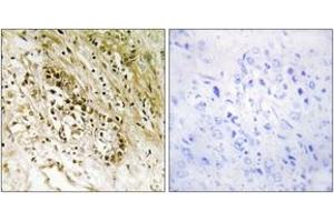 Immunohistochemistry analysis of paraffin-embedded human heart tissue, using PDZD2 Antibody. (PDZD2 抗体  (AA 51-100))