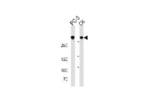 FLNA Antibody (ABIN1882243 and ABIN2838478) western blot analysis in PC-3 and C6 cell line lysates (35 μg/lane). (Filamin A 抗体  (AA 1-360))