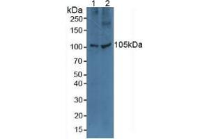 Western blot analysis of (1) Human A549 Cells and (2) Human HeLa cells. (TLR5 抗体  (AA 46-205))