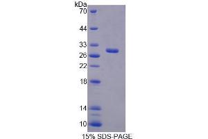SDS-PAGE analysis of Mouse RFC4 Protein.