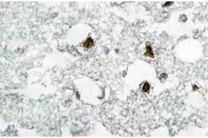 Immunohistochemistry (IHC) analyzes of p27 antibody in paraffin-embedded human brain tissue. (CDKN1B 抗体)