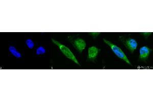 Immunocytochemistry/Immunofluorescence analysis using Rabbit Anti-GRP78 Polyclonal Antibody . (GRP78 抗体  (PerCP))