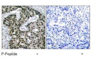Image no. 1 for anti-Heat Shock Factor Protein 1 (HSF1) (pSer303) antibody (ABIN197025) (HSF1 抗体  (pSer303))