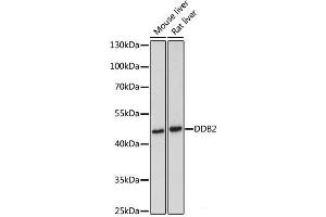 Western blot analysis of extracts of various cell lines using DDB2 Polyclonal Antibody at dilution of 1:500. (DDB2 抗体)