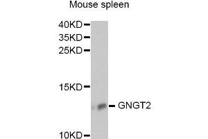 Western blot analysis of extracts of mouse spleen, using GNGT2 antibody (ABIN6292958) at 1:1000 dilution. (GNGT2 抗体)