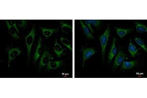 ICC/IF Image TRAP1 antibody detects TRAP1 protein at mitochondria by immunofluorescent analysis. (TRAP1 抗体)