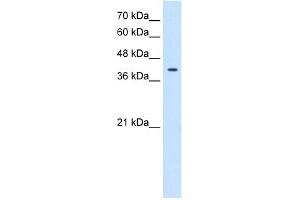 WB Suggested Anti-TSPAN12 Antibody Titration:  0. (TSPAN12 抗体  (Middle Region))