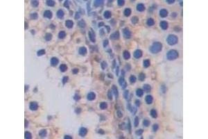 Immunohistochemistry (IHC) image for anti-Solute Carrier Family 2 (Facilitated Glucose Transporter), Member 14 (SLC2A14) (AA 1-105) antibody (ABIN7443179)