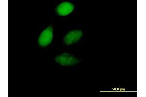 Immunofluorescence of purified MaxPab antibody to ZFP276 on HeLa cell. (ZNF276 抗体  (AA 1-373))