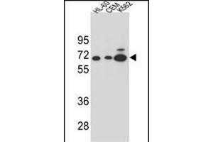 Y2B Antibody (N-term) (ABIN654651 and ABIN2844347) western blot analysis in HL-60,CEM and K562 cell line lysates (35 μg/lane). (AMY2B 抗体  (N-Term))