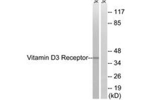 Western blot analysis of extracts from Jurkat cells, using Vitamin D3 Receptor (Ab-51) Antibody. (Vitamin D Receptor 抗体  (AA 16-65))