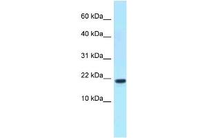 WB Suggested Anti-XAGE1D Antibody Titration: 1. (XAGE1D 抗体  (C-Term))