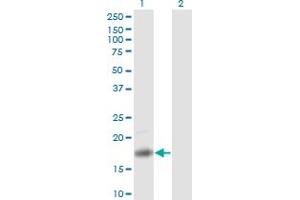Western Blot analysis of PTN expression in transfected 293T cell line by PTN monoclonal antibody (M01), clone 5C3. (Pleiotrophin 抗体  (AA 45-154))