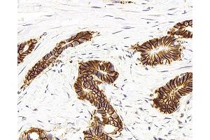 Immunohistochemistry analysis of paraffin-embedded human colon using Na+/K+-ATPase alpha1 Polyclonal Antibody at dilution of 1:300. (ATP1A1 抗体)