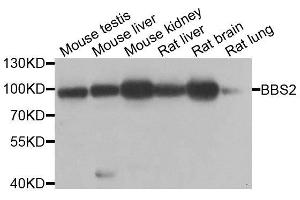 Western blot analysis of extracts of various cell lines, using BBS2 antibody. (BBS2 抗体  (AA 1-96))