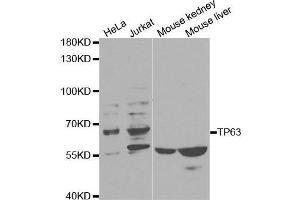 Western blot analysis of extracts of various cell lines, using TP63 antibody. (p63 抗体  (AA 421-680))
