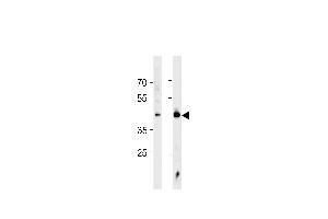 HSF1 Antibody (ABIN389069 and ABIN2839273) western blot analysis in Jurkat cell line and mouse heart tissue lysates (35 μg/lane). (HSF1 抗体  (Sumoylation Site))