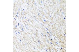 Immunohistochemistry of paraffin-embedded mouse heart using L2HGDH antibody (ABIN5975242) at dilution of 1/100 (40x lens). (L2HGDH 抗体)