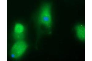 Image no. 1 for anti-UDP-GlcNAc:BetaGal beta-1,3-N-Acetylglucosaminyltransferase 2 (B3GNT2) antibody (ABIN1496799) (B3GNT2 抗体)