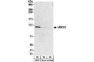 anti-Ubiquitin Protein Ligase E3C (UBE3C) (AA 350-400) antibody
