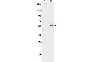 Image no. 6 for anti-V-Akt Murine Thymoma Viral Oncogene Homolog 1 (AKT1) (pSer473) antibody (ABIN1099896) (AKT1 抗体  (pSer473))