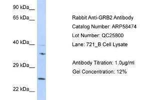 Western Blotting (WB) image for anti-Growth Factor Receptor-Bound Protein 2 (GRB2) (N-Term) antibody (ABIN2787701) (GRB2 抗体  (N-Term))