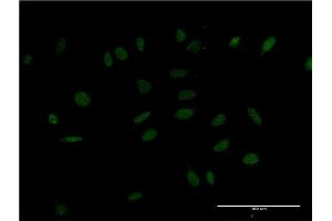 Immunofluorescence of monoclonal antibody to HMX2 on HeLa cell. (HMX2 抗体  (AA 125-224))