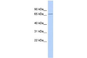 WB Suggested Anti-ZNF404 Antibody Titration:  0. (ZNF404 抗体  (Middle Region))