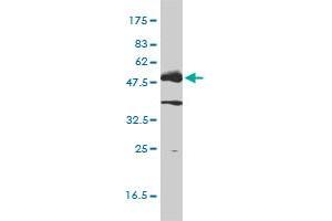 LCK monoclonal antibody (M01), clone 3F7-F5 Western Blot analysis of LCK expression in Jurkat . (LCK 抗体  (AA 1-539))