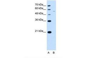 Image no. 2 for anti-arginine/serine-Rich Coiled-Coil 2 (RSRC2) (AA 363-412) antibody (ABIN321837) (RSRC2 抗体  (AA 363-412))