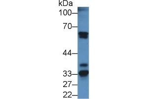 Detection of FGA in Mouse Kidney lysate using Polyclonal Antibody to Fibrinogen Alpha Chain (FGA) (FGA 抗体  (AA 34-255))