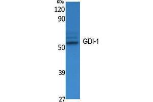 Western Blotting (WB) image for anti-GDP Dissociation Inhibitor 1 (GDI1) (C-Term) antibody (ABIN3187603) (GDI1 抗体  (C-Term))