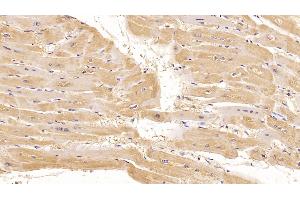 Detection of CTGF in Human Cardiac Muscle Tissue using Monoclonal Antibody to Connective Tissue Growth Factor (CTGF) (CTGF 抗体  (AA 248-349))