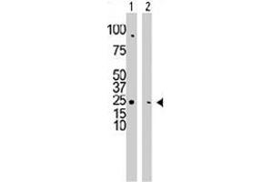 The CMPK1 polyclonal antibody  is used in Western blot to detect CMPK1 in HepG2 cell lysate (Lane 1) and mouse cerebellum tissue lysate (Lane 2) . (Cytidine Monophosphate (UMP-CMP) Kinase 1, Cytosolic (CMPK1) (C-Term) 抗体)