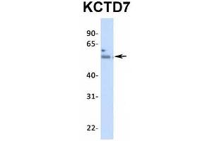 Host:  Rabbit  Target Name:  KCTD7  Sample Type:  Human Fetal Heart  Antibody Dilution:  1. (KCTD7 抗体  (N-Term))