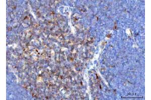 IHC analysis of TCR alpha/TRAC using anti-TCR alpha/TRAC antibody (ABIN6719654). (TRAC 抗体  (AA 1-114))