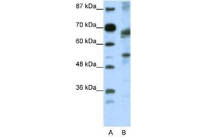 WB Suggested Anti-TCF12  Antibody Titration: 0. (TCF12 抗体  (N-Term))