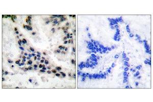 Immunohistochemistry (IHC) image for anti-Histone Deacetylase 1 (HDAC1) (C-Term) antibody (ABIN1848594) (HDAC1 抗体  (C-Term))