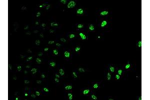 Immunofluorescence analysis of HeLa cells using E2F6 antibody. (E2F6 抗体)