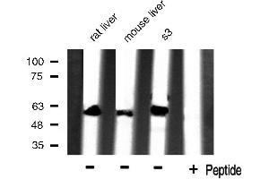 Western blot analysis of extracts of various celllines,using HSP60 antibody. (HSPD1 抗体)