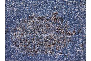 Image no. 4 for anti-Dihydrolipoamide Dehydrogenase (DLD) antibody (ABIN1497846) (DLD 抗体)