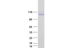 Validation with Western Blot