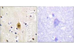 Immunohistochemistry analysis of paraffin-embedded human brain, using Mst1/2 (Phospho-Thr183) Antibody. (MST1/MST2 (AA 149-198), (pThr183) 抗体)