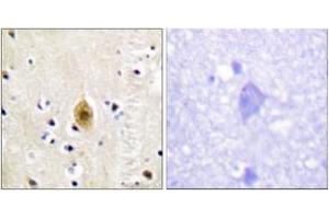 Immunohistochemistry analysis of paraffin-embedded human brain, using Mst1/2 (Phospho-Thr183) Antibody. (MST1/MST2 (AA 149-198), (pThr183) 抗体)