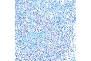 Immunohistochemistry of paraffin-embedded mouse spleen using SNRPB Rabbit pAb (ABIN6134519, ABIN6148214, ABIN6148215 and ABIN6219175) at dilution of 1:100 (40x lens). (SNRPB 抗体  (AA 1-100))