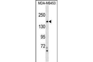 Western blot analysis in MDA-MB453 cell line lysates (35ug/lane). (NFKBIL2 抗体  (N-Term))