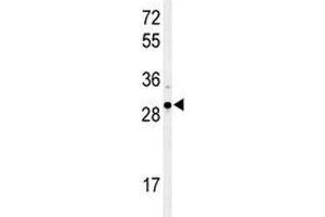 Western blot analysis of XBP1 antibody and Ramos lysate. (XBP1 抗体  (AA 62-91))