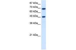 WB Suggested Anti-RRP9 Antibody Titration:  5. (RRP9 抗体  (Middle Region))