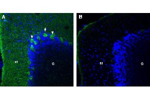 Expression of CD38 in rat cerebellum. (CD38 抗体  (Extracellular))